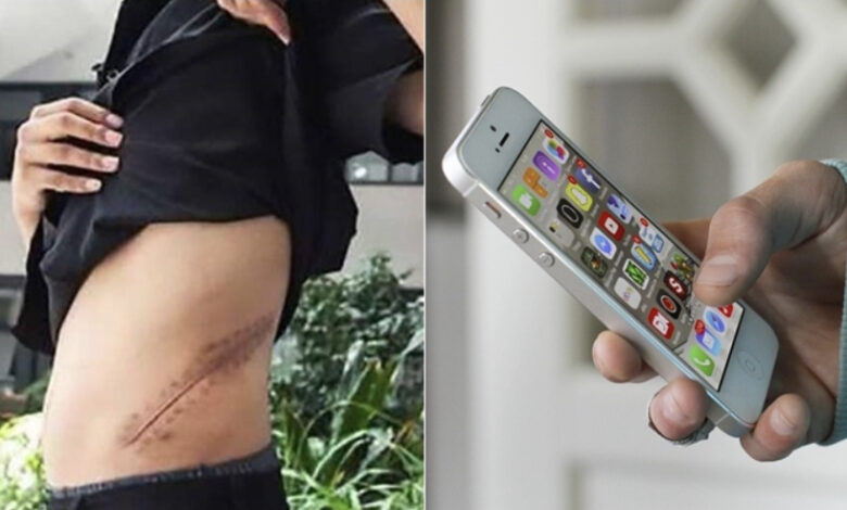 Për t’u habitur, 17 vjeçari shet veshkën për të blerë iPhone-in e fundit 1